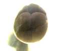 Achtzellenstsdium